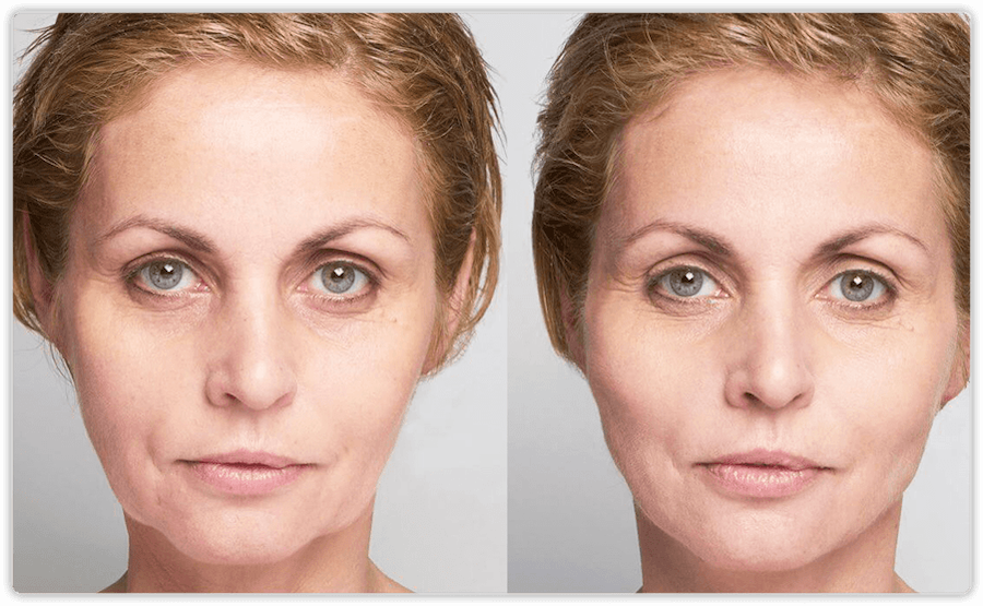 Before and After 1