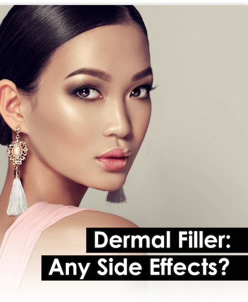 Dermal Filler Side Effects