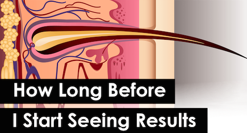 Hair Loss Results - How long.