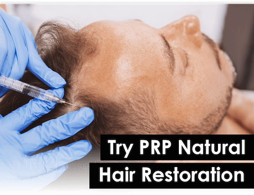 Natural Hair Loss Treatment - PRP