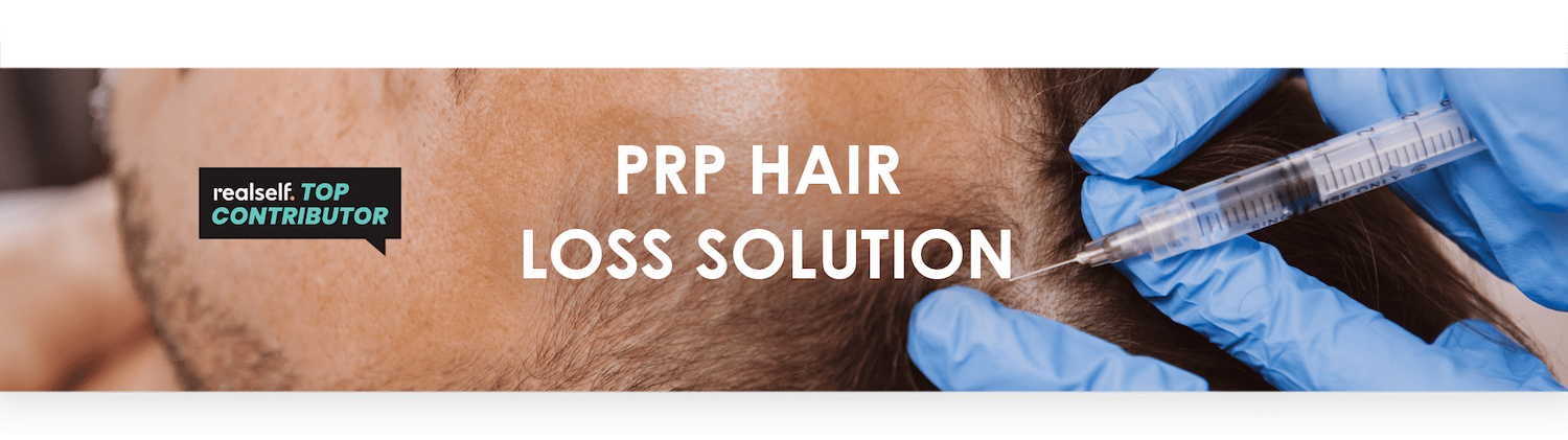 Natural Hair Loss Treatment - PRP