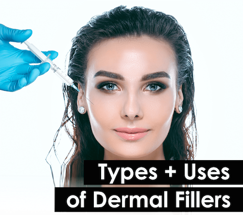 Types of Dermal Fillers in Mississauga