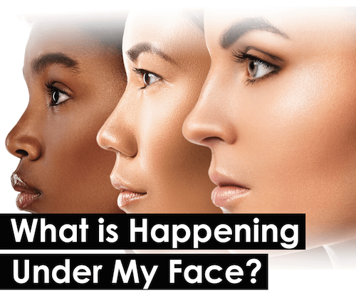 Underneath my face skin - Toronto