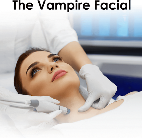 The Vampire Facial Toronto - PRP Facelift Lip Doctor