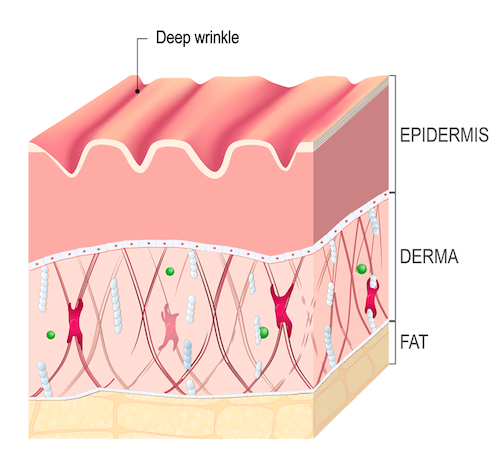 What Causes Your Wrinkles