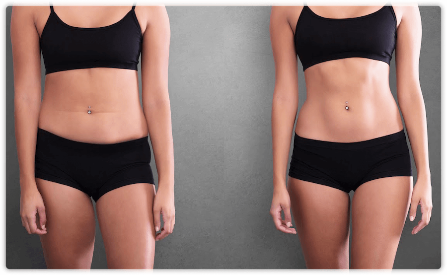 Before and After